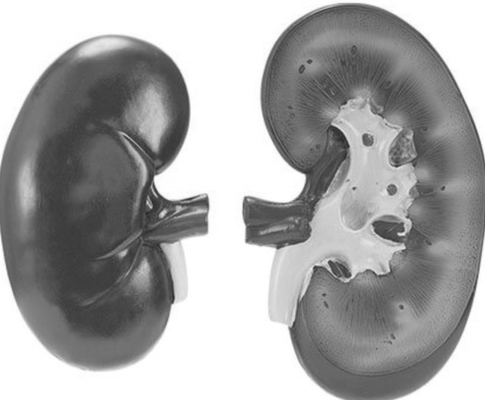 Вплив дієт на здоров’я нирок